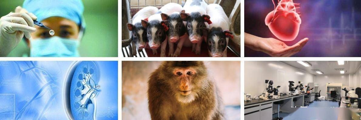 <em>西京医院</em>完成国际首例六基因编辑猪-猴多器官多组织同期移植