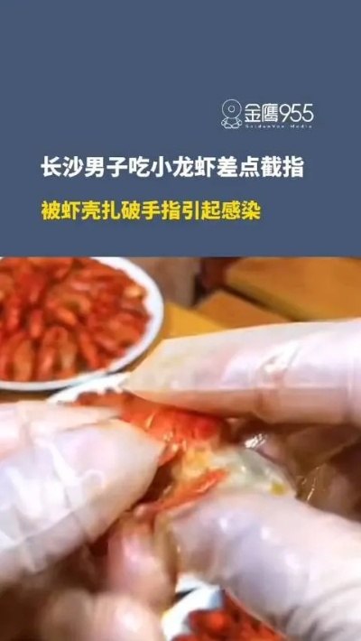 男子吃龙虾被虾壳背刺险截肢#进入夏.来自长沙<em>头条</em>-微博