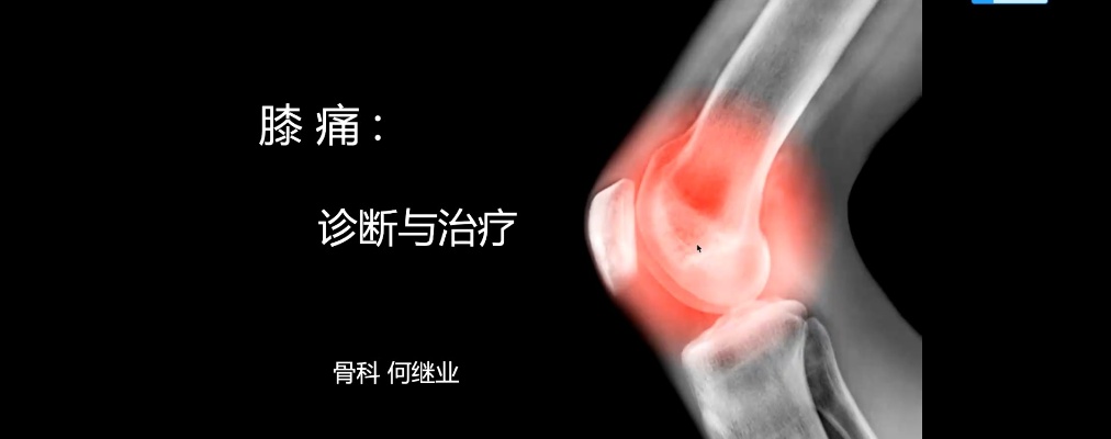2021-05-19 膝关节损伤公益科普讲座-上海<em>新华医院</em> 何继业