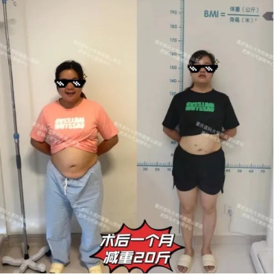 <em>重庆</em>医科大学附属璧山医院：打造肥胖症患者减重代谢手术特色服务