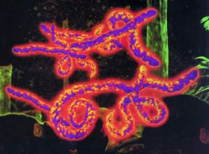 埃博拉病毒电影_埃博拉病毒怎么来的_埃博拉病毒是什么病毒