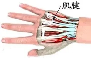 手指伸不直，警惕肌腱断裂！儿童<em>医院</em>|郭海滨|肌腱|手指|<em>骨科</em>|关节|健康界