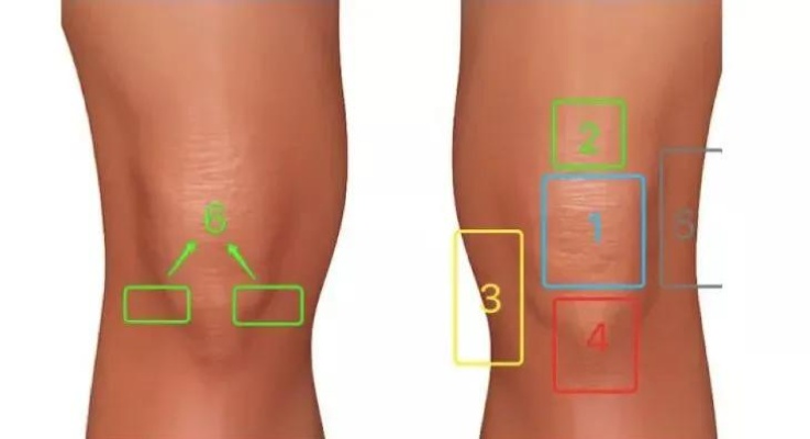 <em>郴州骨科医院</em>为您推荐一张图告诉你<em>膝盖</em>疼痛位置与对应病症！<em>膝关节</em>_区域_损伤