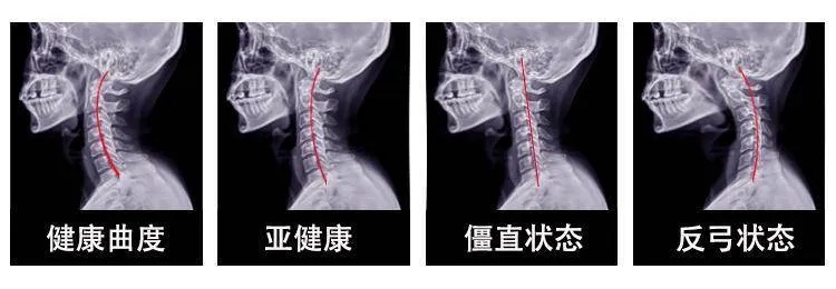 杭州城东<em>医院骨科</em>提醒别让这几个动作摧残你的颈椎了！最后一个可能现在就在做