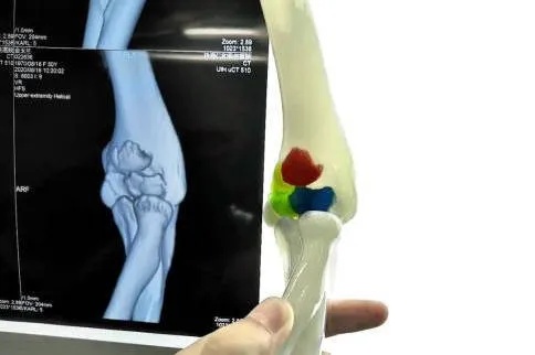 赛纳三维新领域—赛纳数字医疗3D打印在<em>骨科</em>的应用_手术_模型_状况