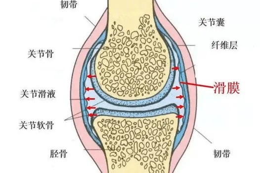 【<em>福州中德骨科医院</em>】有一种关节肿，叫做滑膜炎