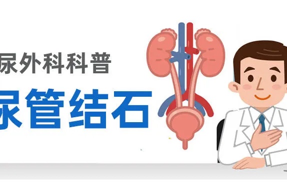 <em>杭州城东医院</em>泌尿<em>外科</em>李智：输尿管结石，你真的了解吗？