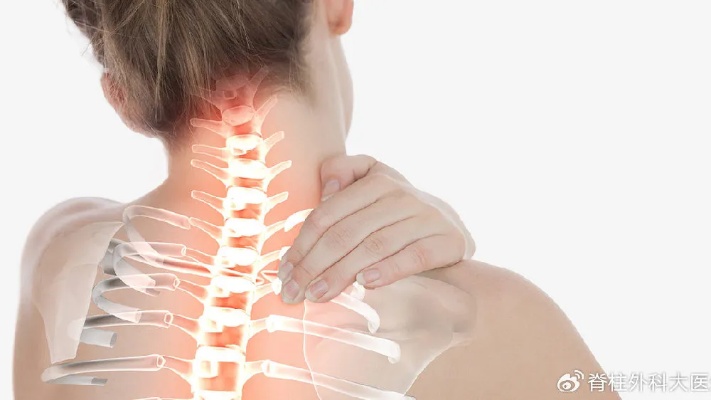 颈部肌肉劳损可以做这六个运动，放松肌肉.来自<em>脊柱外科</em>大<em>医生</em>-微博