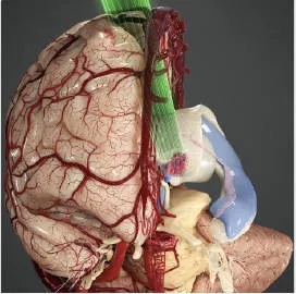 这个大脑的插图画的真漂亮，当然<em>图片</em>的意思是表示进入丘脑附近的肿瘤手术径路 ​​​​