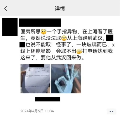 手指扎了一小块玻璃，从<em>上海</em>跑到武汉，知名医院都说做不了？