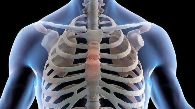 胸肋骨<em>骨折</em>的症状有哪些？<em>胸骨骨折</em>外固定保守疗法及百达智美医学肋骨固定夹板用法？