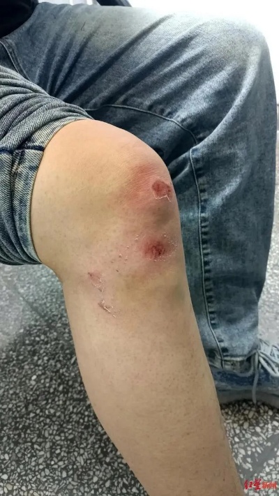 警方回应<em>宁夏</em>一出租车司机遭乘客殴打 施暴者已受罚