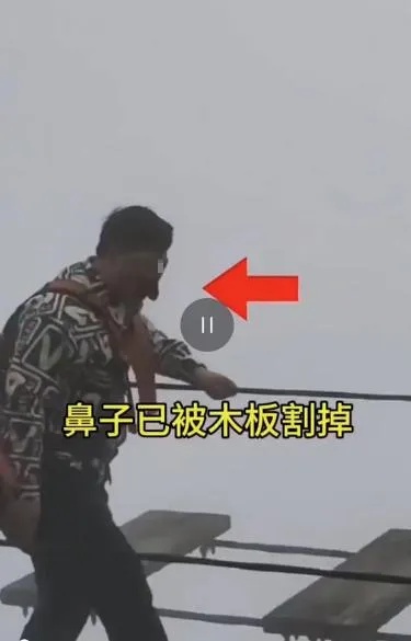 游客<em>贵州</em>铜仁玩“步步惊心”桥鼻子被割？假的！