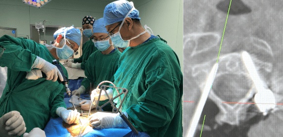 福利院11岁女童险截瘫，<em>骨科</em>机器人助力医生完成高难度手术！