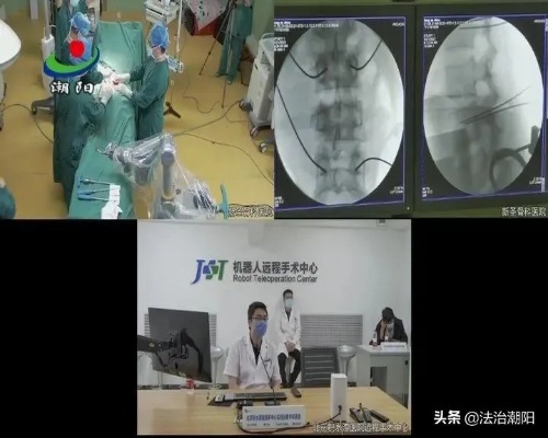 濠江新圣<em>骨科</em>医院：通过远程机器人成功实施骨折手术