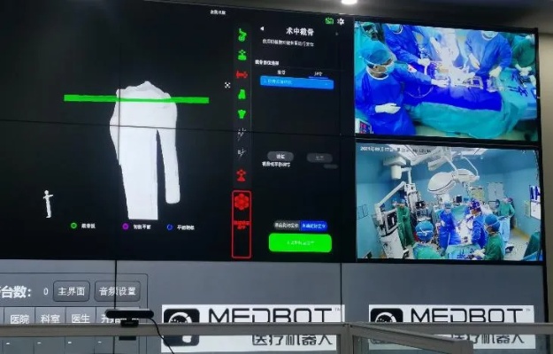 上海九<em>院骨科</em>团队完成首例国产<em>骨科</em>手术机器人5G远程膝关节置换手术