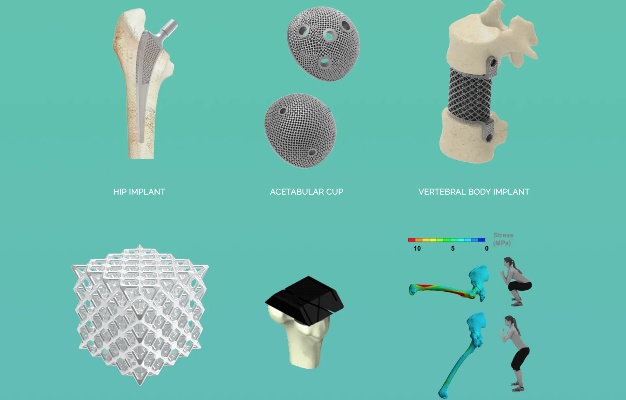 帮<em>骨科医生</em>定制骨骼植入物，3D打印如何助推精准医疗？