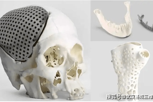 <em>武汉</em>3d打印服务中心-3D打印在<em>骨科</em>领域的应用和局限性