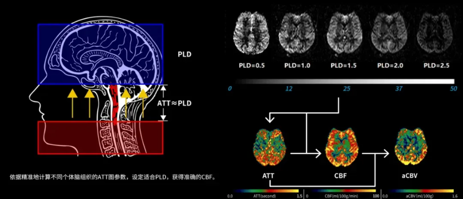 简讯|中国人脑血流量常模研究在<em>天坛医院</em>等多中心启动